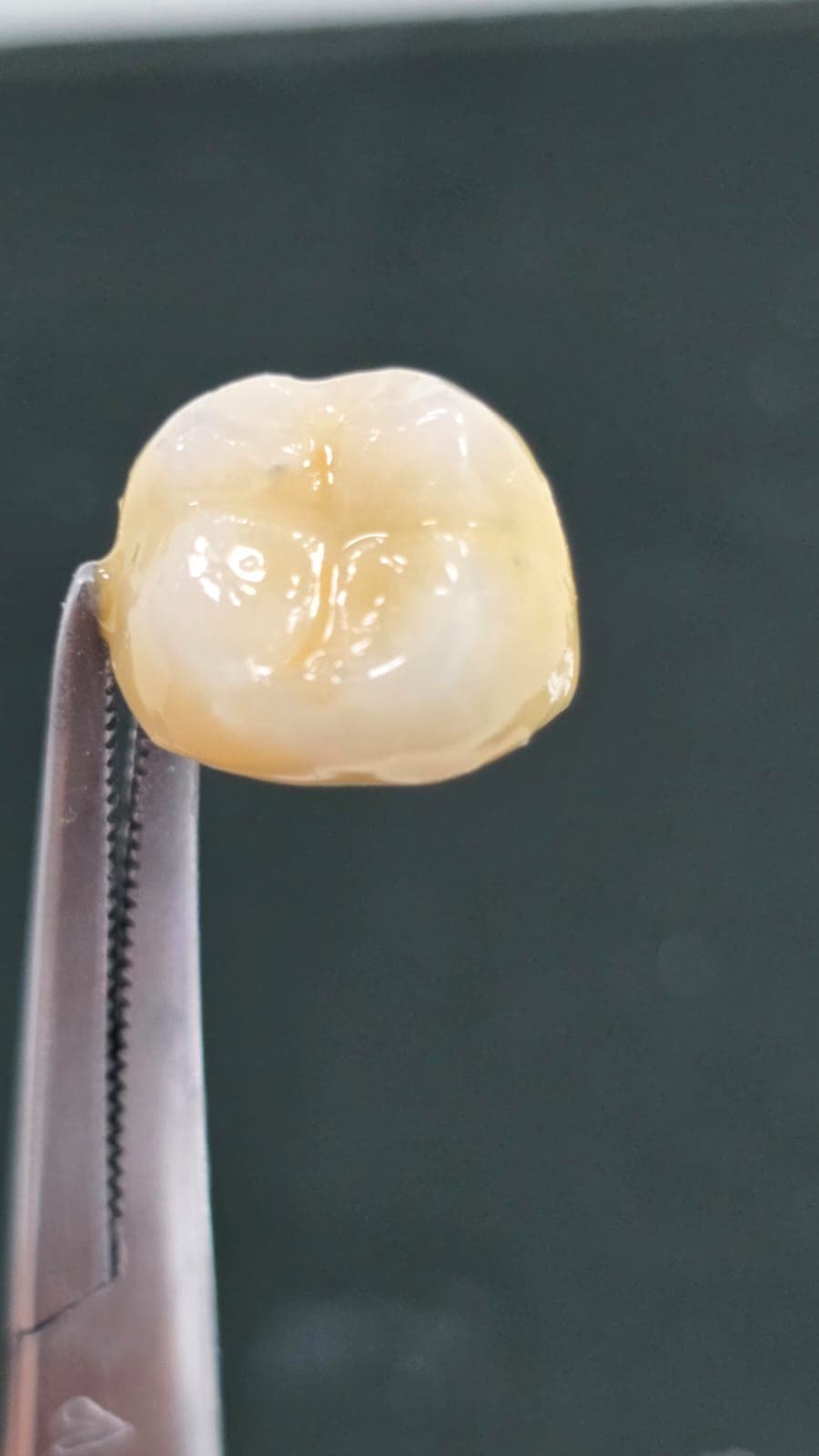 Trabajo dental 2