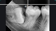 Trabajo dental 3