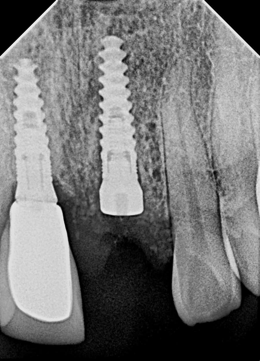 Trabajo dental 4